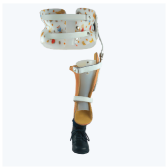 Prothèse pour agénésie